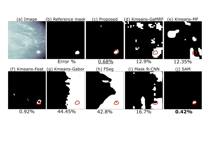 Mammography imaging for tumor detection
